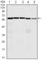Cell Division Cycle 25C antibody, GTX82998, GeneTex, Western Blot image 
