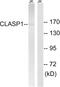 Cytoplasmic Linker Associated Protein 1 antibody, abx014374, Abbexa, Western Blot image 