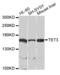 Tet Methylcytosine Dioxygenase 3 antibody, orb373651, Biorbyt, Western Blot image 