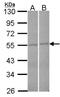 F-Box And Leucine Rich Repeat Protein 2 antibody, NBP1-33641, Novus Biologicals, Western Blot image 