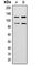 Zinc finger protein 148 antibody, abx121821, Abbexa, Western Blot image 