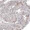 Preferentially Expressed Antigen In Melanoma antibody, NBP2-61149, Novus Biologicals, Immunohistochemistry paraffin image 