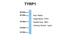 Tyrosinase Related Protein 1 antibody, NBP1-69542, Novus Biologicals, Western Blot image 