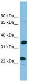 Proenkephalin-B antibody, TA344666, Origene, Western Blot image 
