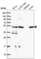Trafficking From ER To Golgi Regulator antibody, NBP2-56681, Novus Biologicals, Western Blot image 