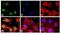 Signal Transducer And Activator Of Transcription 5A antibody, GTX13593, GeneTex, Immunocytochemistry image 