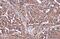 Pyruvate Kinase M1/2 antibody, GTX634796, GeneTex, Immunohistochemistry paraffin image 