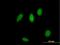 Zinc Finger Protein 83 antibody, H00055769-B01P, Novus Biologicals, Immunocytochemistry image 