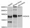 Histone Deacetylase 6 antibody, abx125934, Abbexa, Western Blot image 