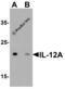 Interleukin-12 subunit alpha antibody, 7497, ProSci Inc, Western Blot image 