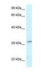 Vesicle Transport Through Interaction With T-SNAREs 1B antibody, orb331147, Biorbyt, Western Blot image 