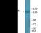 Insulin Receptor Substrate 1 antibody, EKC2438, Boster Biological Technology, Western Blot image 