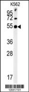 Synaptotagmin 13 antibody, 61-946, ProSci, Western Blot image 