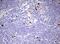 KI-67 antibody, TA803157AM, Origene, Immunohistochemistry frozen image 