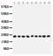 Ribonuclease A Family Member 1, Pancreatic antibody, PA1507, Boster Biological Technology, Western Blot image 