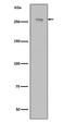 Leucine Rich Repeat Kinase 2 antibody, M00221, Boster Biological Technology, Western Blot image 