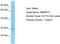 Transmembrane Protein 215 antibody, TA330790, Origene, Western Blot image 