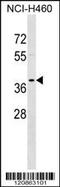 Tropomyosin 2 antibody, 59-276, ProSci, Western Blot image 