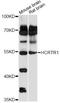 Hypocretin Receptor 1 antibody, LS-C749722, Lifespan Biosciences, Western Blot image 