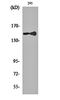 Phospholipase C Gamma 1 antibody, orb162434, Biorbyt, Western Blot image 