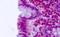 Cadherin EGF LAG Seven-Pass G-Type Receptor 2 antibody, NLS1939, Novus Biologicals, Immunohistochemistry paraffin image 