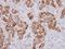 Protein Kinase D3 antibody, NBP2-19958, Novus Biologicals, Immunohistochemistry paraffin image 