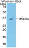 Raftlin, Lipid Raft Linker 1 antibody, MBS2014078, MyBioSource, Western Blot image 