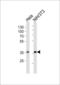 NFKB Inhibitor Alpha antibody, LS-C204023, Lifespan Biosciences, Western Blot image 