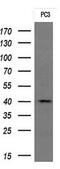 Transmembrane Protein 173 antibody, M01871-1, Boster Biological Technology, Western Blot image 