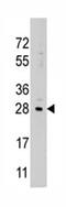Lin-28 Homolog B antibody, ab71415, Abcam, Western Blot image 