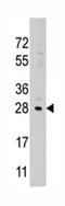 Protein lin-28 homolog B antibody, ab71415, Abcam, Western Blot image 