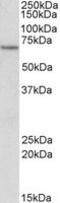 Electron Transfer Flavoprotein Dehydrogenase antibody, LS-C113022, Lifespan Biosciences, Western Blot image 