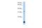 Beta-1,3-Galactosyltransferase 6 antibody, PA5-43534, Invitrogen Antibodies, Western Blot image 