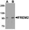 FRAS1 Related Extracellular Matrix 2 antibody, orb94554, Biorbyt, Western Blot image 