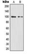 Huntingtin Interacting Protein 1 antibody, orb341197, Biorbyt, Western Blot image 