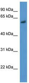 Bardet-Biedl Syndrome 1 antibody, TA344665, Origene, Western Blot image 