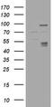 Carbonic Anhydrase 12 antibody, M04063-2, Boster Biological Technology, Western Blot image 