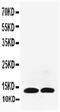 Interleukin 13 antibody, PA5-79464, Invitrogen Antibodies, Western Blot image 