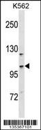 Coiled-Coil And C2 Domain Containing 1A antibody, 58-358, ProSci, Western Blot image 