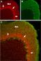 Sodium Voltage-Gated Channel Alpha Subunit 1 antibody, PA5-77721, Invitrogen Antibodies, Immunohistochemistry paraffin image 