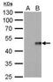 Interleukin-28B antibody, NBP2-43738, Novus Biologicals, Western Blot image 