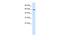 Zinc Finger Protein 12 antibody, A11766, Boster Biological Technology, Western Blot image 