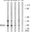 Phosphatidylinositol Glycan Anchor Biosynthesis Class X antibody, TA315556, Origene, Western Blot image 