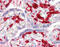 Coagulation factor XIII A chain antibody, 51-856, ProSci, Enzyme Linked Immunosorbent Assay image 