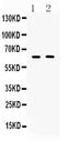 Tubby protein homolog antibody, A02917-1, Boster Biological Technology, Western Blot image 