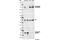 LCK Proto-Oncogene, Src Family Tyrosine Kinase antibody, 2102P, Cell Signaling Technology, Western Blot image 