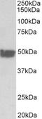 Keratin 20 antibody, EB11746, Everest Biotech, Western Blot image 