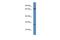 Coagulation Factor XI antibody, A00989, Boster Biological Technology, Western Blot image 