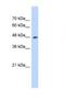 Hydroxyacyl-CoA Dehydrogenase Trifunctional Multienzyme Complex Subunit Beta antibody, NBP1-54750, Novus Biologicals, Western Blot image 