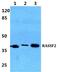 Ras Association Domain Family Member 2 antibody, PA5-75556, Invitrogen Antibodies, Western Blot image 